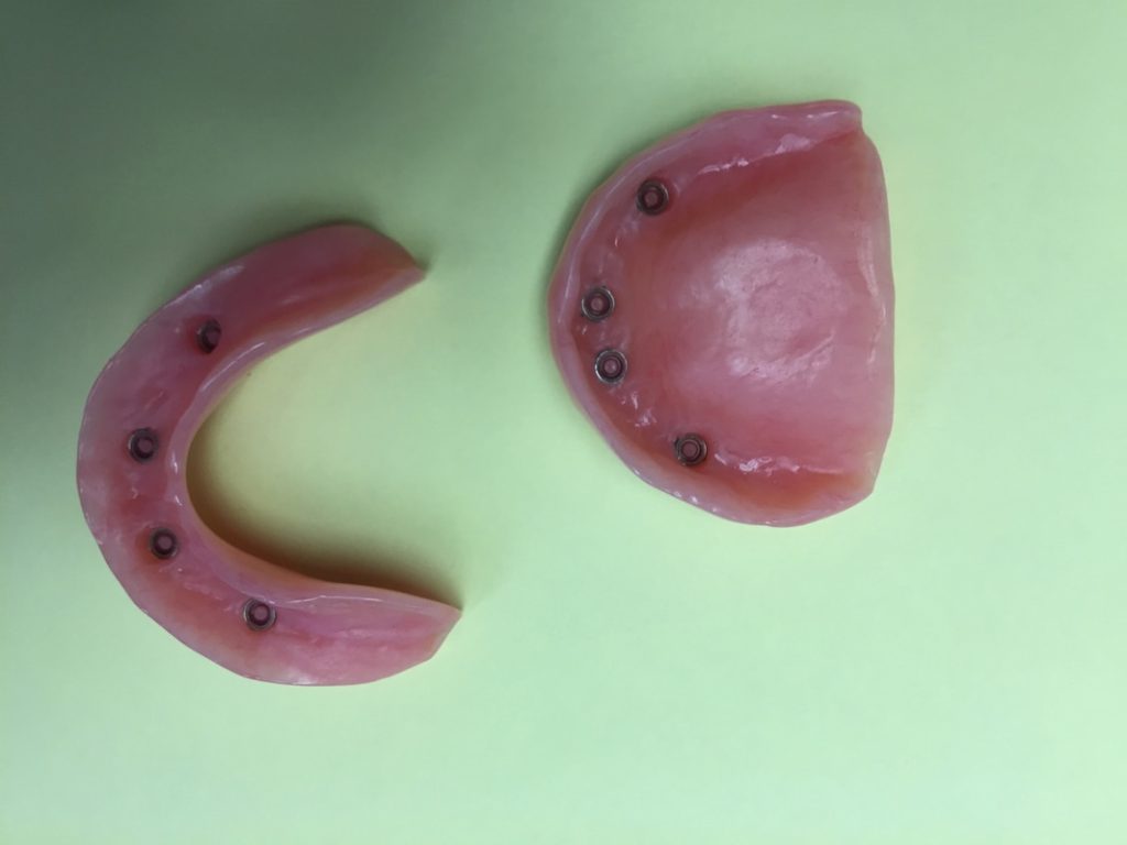 Dentures - Oasis Dental Care - Flagstaff, AZ